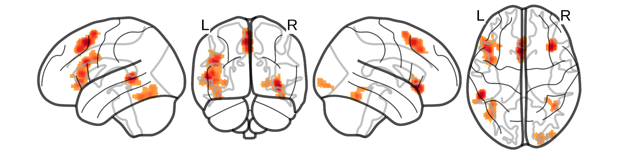 meta-analytic results from ALE